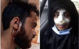 IMG 20210917 112211 670 160x100 دو نفر دیگر بعد از تذکر «کشف حجاب» کتک خوردند