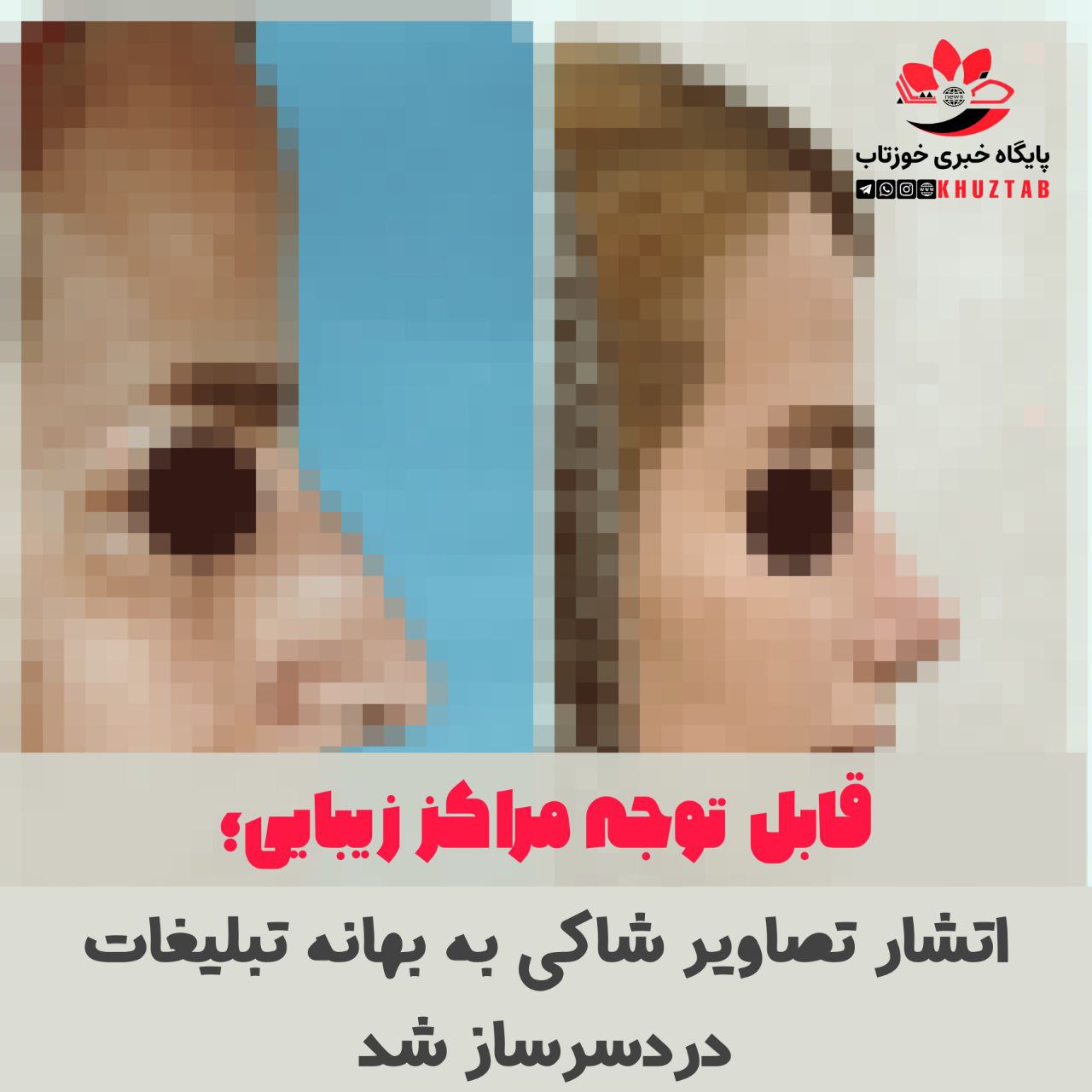 IMG 20220219 210117 341 انتشار تصاویر شاکی به بهانه تبلیغات دردسر ساز شد