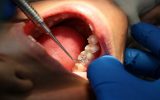 17000847 337.jfif  160x100 ویزیت رایگان دندانپزشکی برای نیازمندان اهواز