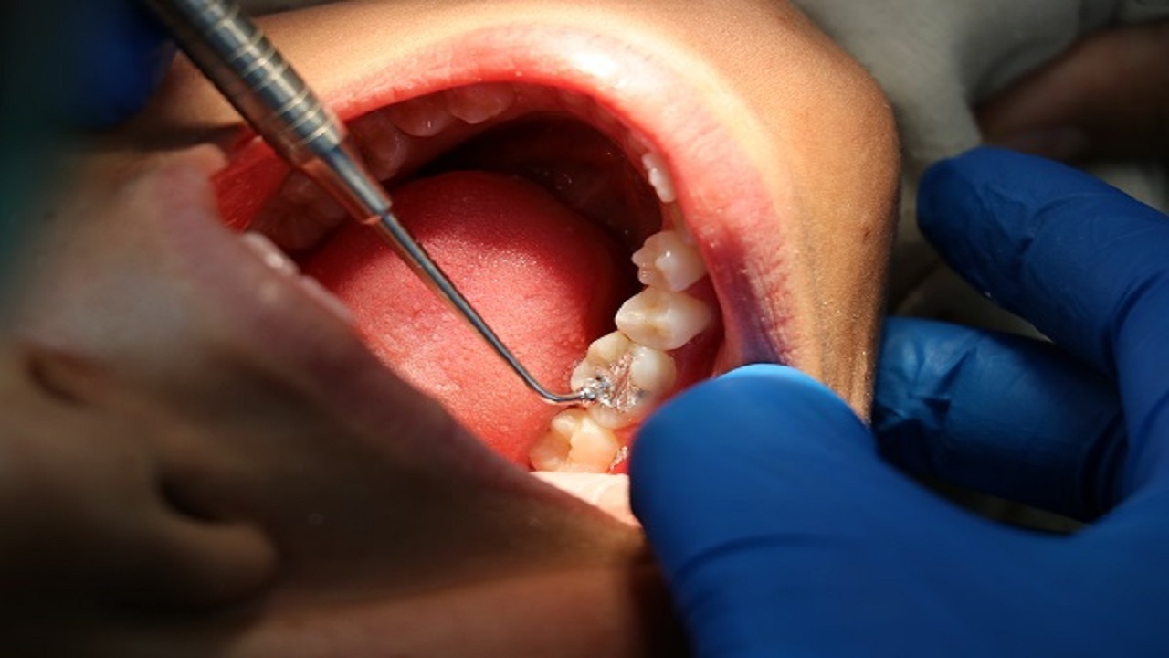 17000847 337.jfif  ویزیت رایگان دندانپزشکی برای نیازمندان اهواز